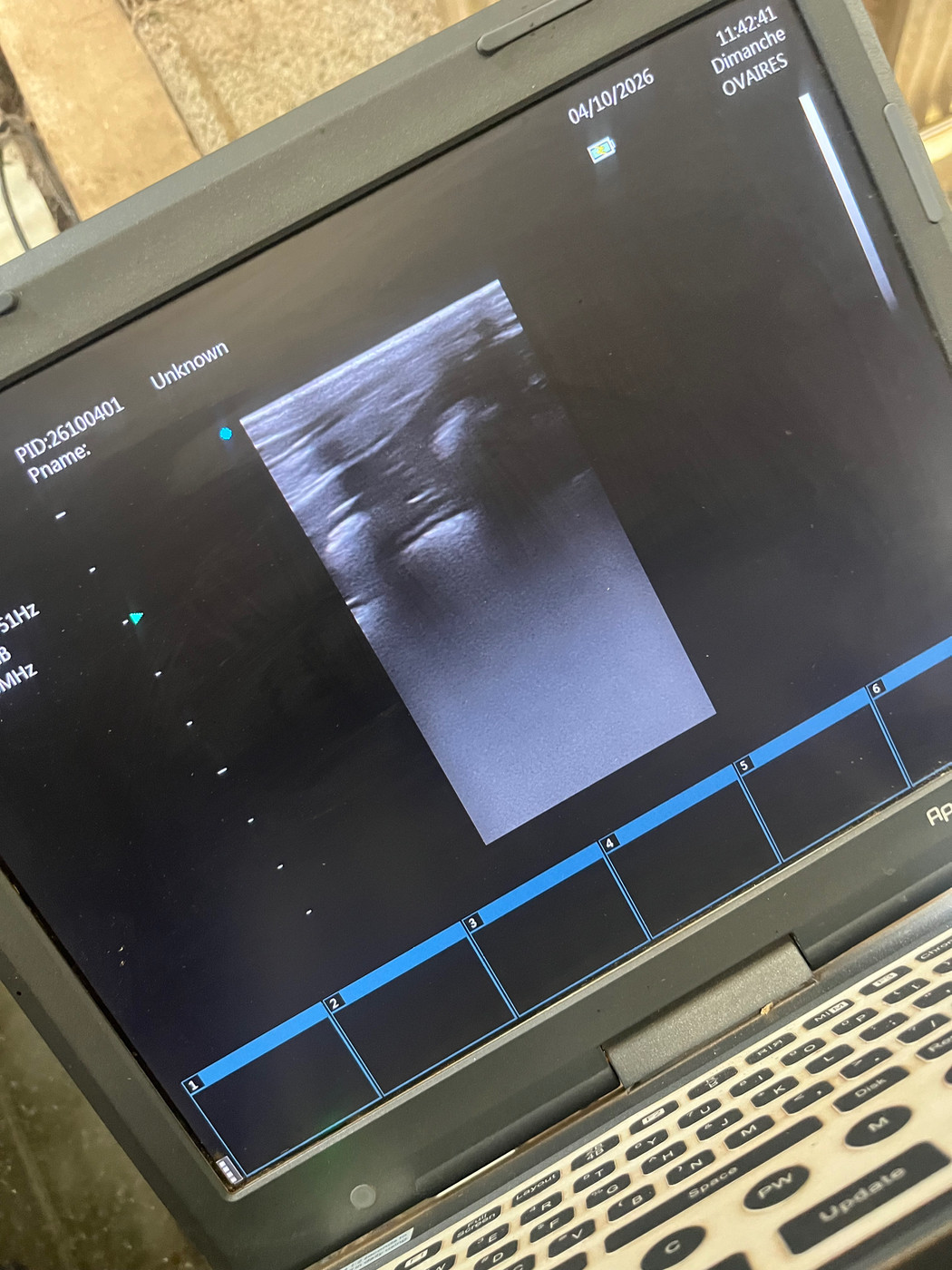 Futurs bébé de Urban et Margot dans moins de 2 mois